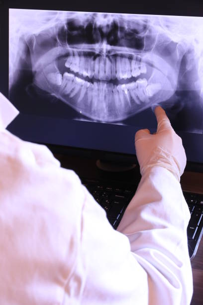 Best Emergency Dental Care for Abscessed Tooth in Abingdon, MD