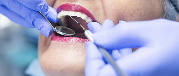 Best Emergency Cosmetic Dentistry in Abingdon, MD